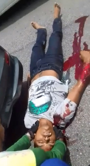 Thug Suffers after Landing on Pavement Beaten by Mob