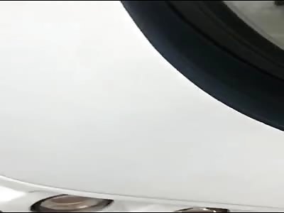 WOMAN WITH SKIN FOOT