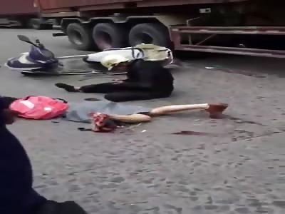 OMG !! Girl Suffers Terrible Accident