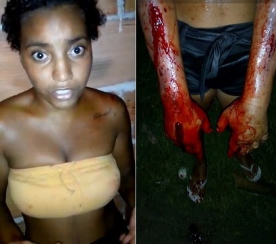 Favela Girl Gets Her Hands Broken With A Hammer