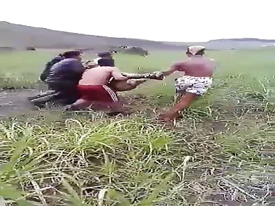 BRUTAL: MAN WITH BURNS THROUGHOUT THE BODY