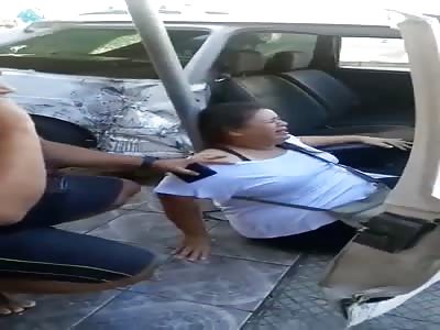  You Can See into the Bone! 