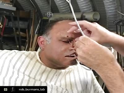 fish hook put on man's face
