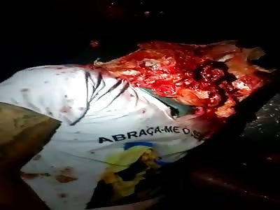 where the fuck was his face ??