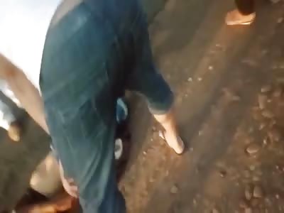 shit, man with exposed leg bone