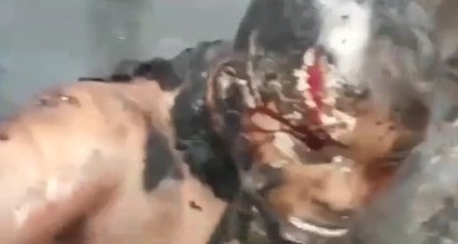 At Least He`s Not Burned to Crisp