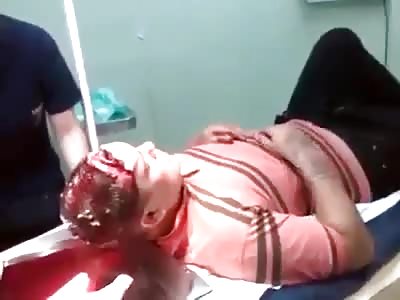 man with big wound on his forehead