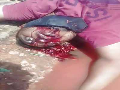 motorcycle accident victim