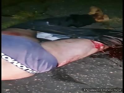 Man with broken leg in accident