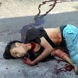 Biker with Neck Slashed by Kite String Performs Agonal Breathing