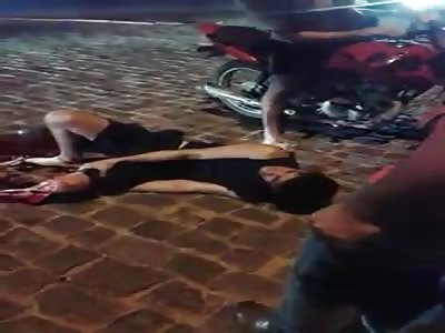 Shit, his foot was smashed