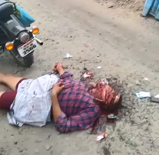 Man Wearing Flip Flop Found Hacked to Death in Field â€“ Head Shredded