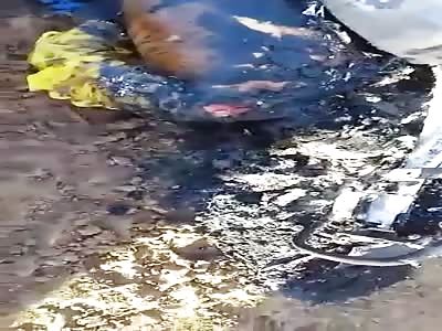 Roasted motorcyclist after accident