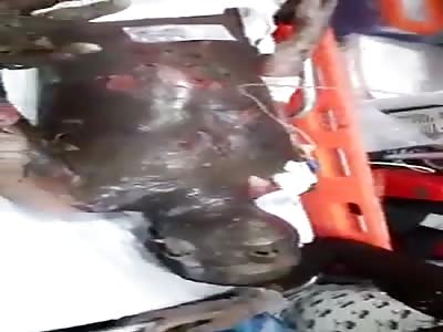 BBQ: VICTIM OF ACCIDENT