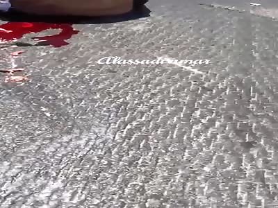 Holy shit: man with a destroyed head