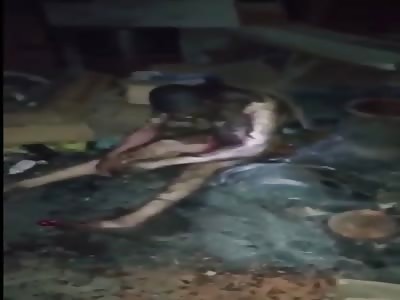 man burned inside home