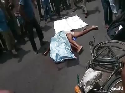 Intestines Evacuated through the Shoulder...purulia,WB 