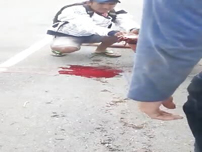 Biker's leg badly damaged