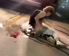 Biker tries to move with busted gut