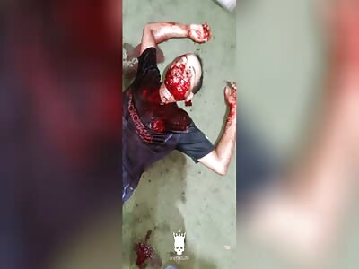 About 15 anti-socials arrived with weapons in hand and began to shoot (aftermath)