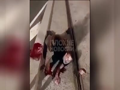 FRANCE: Dude Has Both Hands Cut off for Protecting his Car.