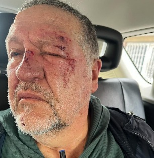 Pedestrian stumbles and falls to the ground but is savagely beaten by 