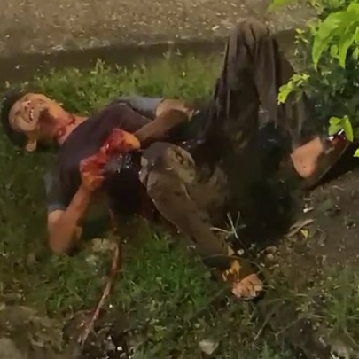 You Should Put that Back Inside Your Stomach