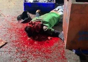 Angry worker smashed the skull of his teammate 