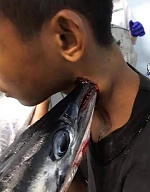 Death, Illness, Injury, Healing #15 (compilation)