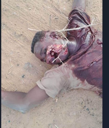 horrific scenario of war in yemen