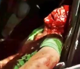 A man in a car is in agony after being shot with a machine gun
