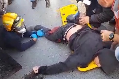 Removing twisted legs young man from under big truck and he still aliv