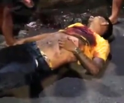 A young man was shot during a robbery