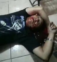 An amateur musician was shot