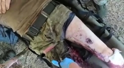 ORC receiving first aid