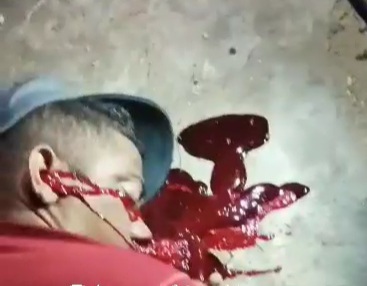 Young man killed by headshot 