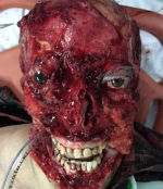 Death, Illness, Injury, Healing #18 (compilation)