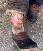 18yo drug addict shows the state of his body