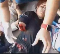 Truck Accident Takes Woman's Arm as a Souvenir