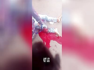 Leg Breaking Landing