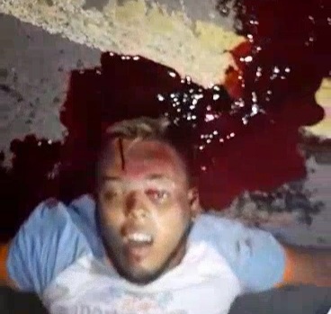 (2)Deadly motorcycle accident leave young man with cracked skull 