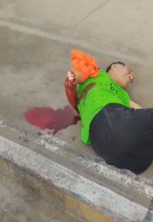 Victim with a terrible arm injury