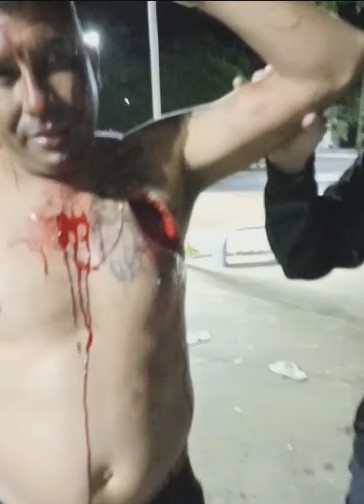 Drunk man stabbed in the chest