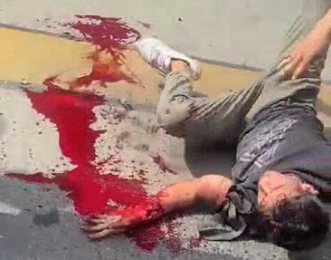 Motorcyclist crossing red light crushed by bus lost his hand