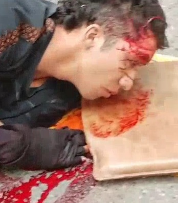 Wounded Motorcyclist waiting for help 