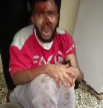 Five Minutes of Horrific Torture of Saoudien Young Man by Kenyan Lady