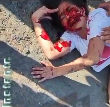 Couple on motorcycle crushed by speeding car