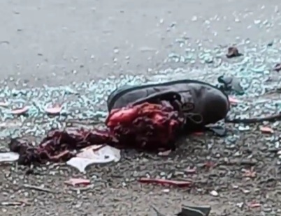 Motorcyclist lost his foot in deadly accident 