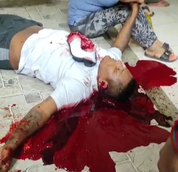 Colombian sicarios hit again another youmg man executed 