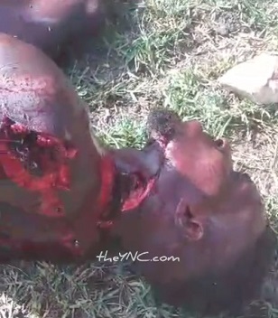 He Shouldn't be Alive